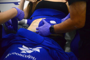 Halley Body Slimming Clinic | CoolSculpting Side Effects: What You Need to Know Before Treatment