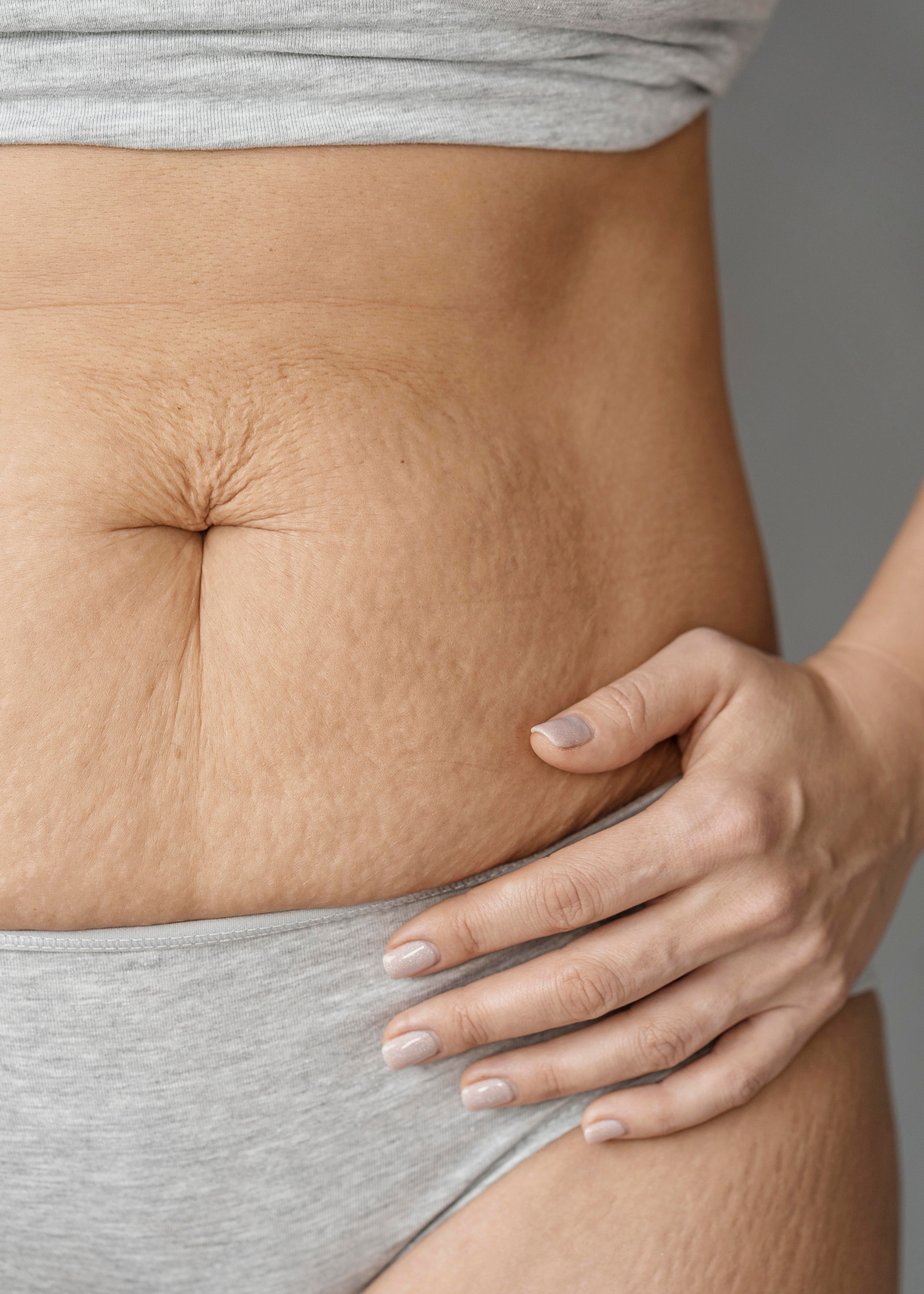 Halley Body Slimming Clinic|Loose skin after weight loss