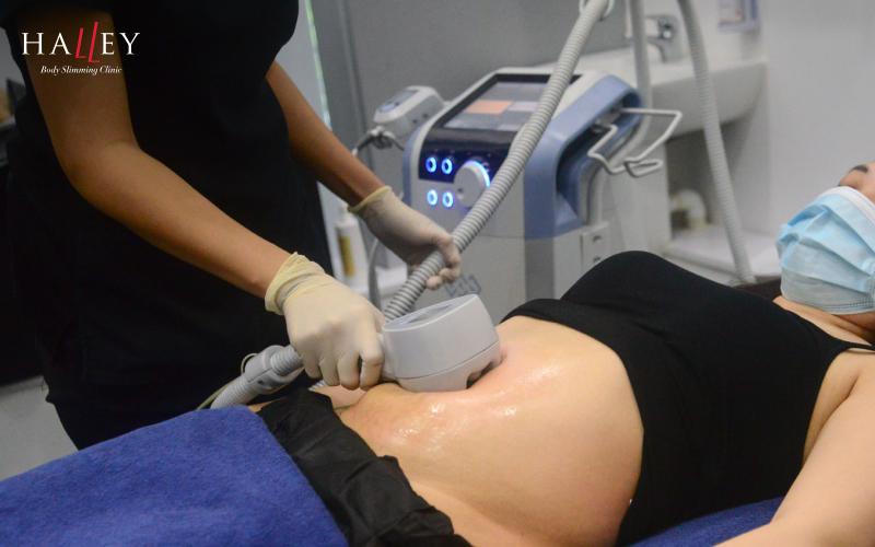 Exilis Ultra 360 treatment for non-surgical postpartum skin tightening.