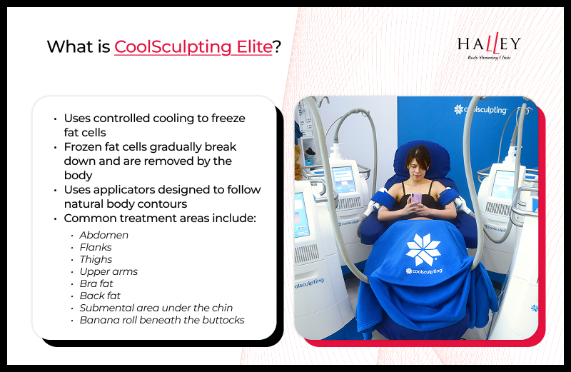 Infographic explaining how CoolSculpting Elite freezes and removes fat.