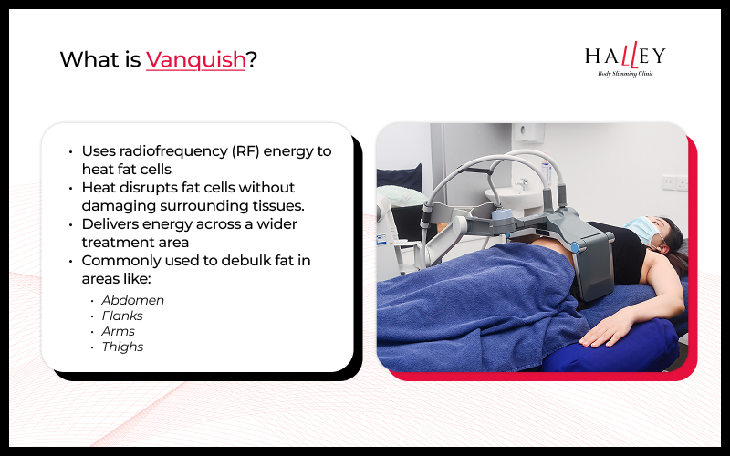Infographic describing Vanquish radiofrequency treatment for non-invasive fat reduction.