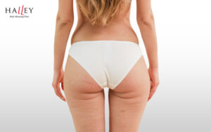 Back view of a woman showing banana roll fat area